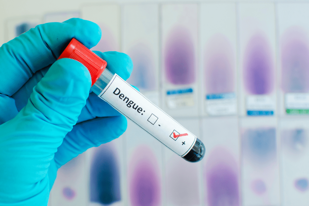 Juiz de Fora investiga primeira morte suspeita por dengue em 2024